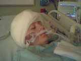 Kendall after brain surgery